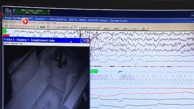 Des jambes qui ne dorment jamais, un vrai syndrome