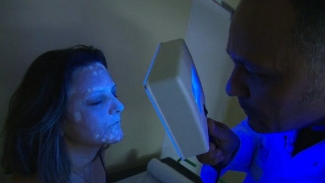 Vitiligo, quand la peau perd sa couleur
