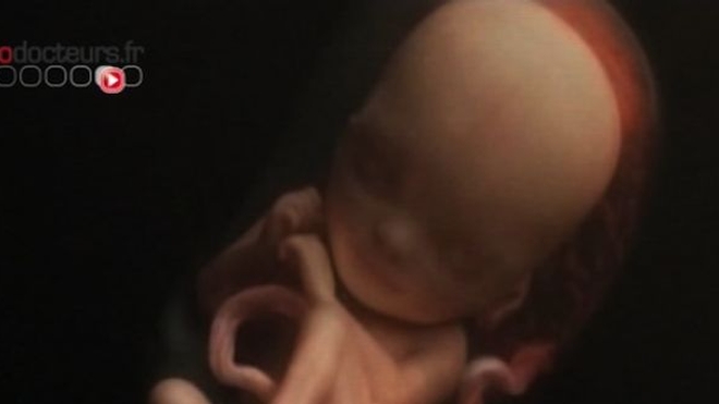 Un foetus momifié dans le ventre depuis 60 ans !