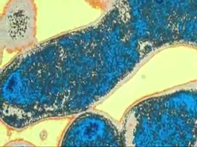 Des bactériophages pour lutter contre les infections