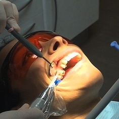 Le douloureux problème des dents sensibles