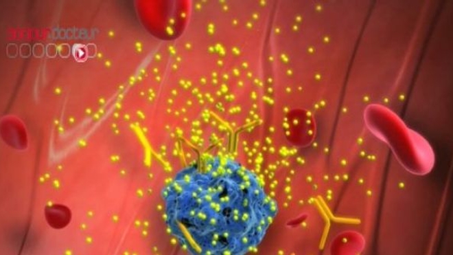 Des nanoparticules pour faire barrage aux métastases