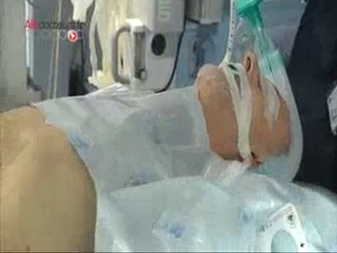 ''Prostate : opérer en ambulatoire'', reportage Eloïse Malet, François Rochelle et Johnny Da Costa