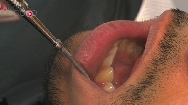 Le dentiste manquait d'hygiène : 22.000 patients rappelés pour dépistage