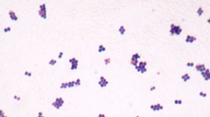 Une infection bactérienne, et que la lumière soit…
