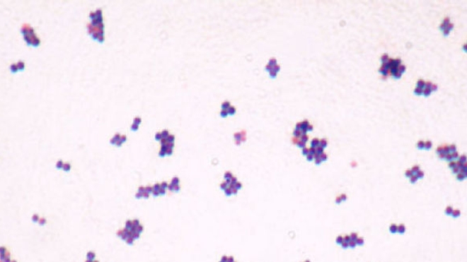 Staphylococcus aureus (Crédit photo : Y. Tambe cc-by-sa)