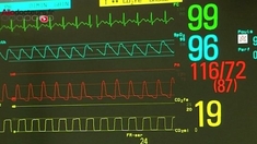 40% des lits de réanimation occupés par des patients Covid en Ile-de-France
