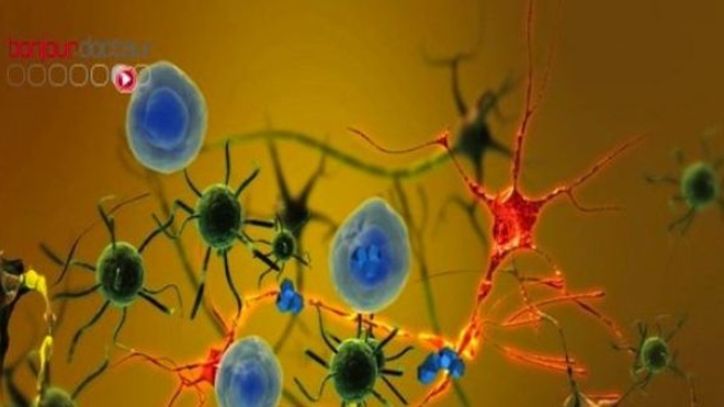 Certains neurones de la substance noire du cerveau sont tellement sollicités au cours de la vie qu'ils finiraient parfois par se détruire, déclenchant la maladie de Parkinson.