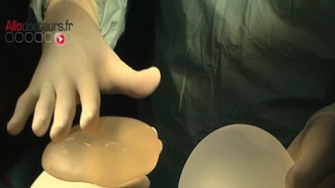 Prothèses mammaires Cereplas retirées du marché