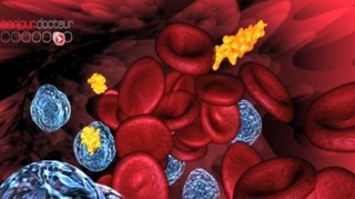 Leucémie : résultats encourageants de l'immunothérapie