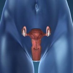 Qu'est-ce qu'un utérus didelphe ?