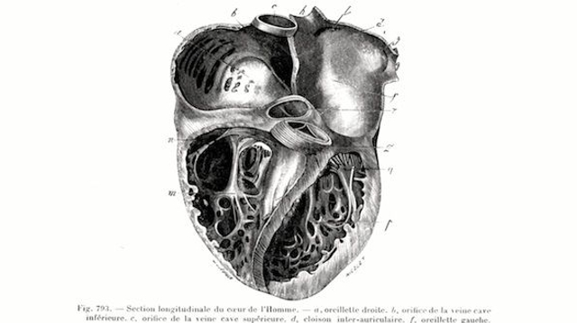 1896 : La première fois qu'un chirurgien a opéré un coeur