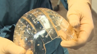 Implantation d'un crâne en plastique
