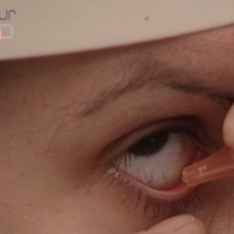 Laser des yeux : les suites opératoires