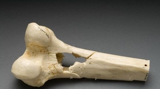 Bientôt une banque d'os artificiels grâce à une imprimante 3D ?
