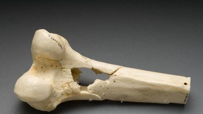 Bientôt des os artificiels grâce à une imprimante 3D ? (Photo CC-BY-SA-PD-USGov-NIH)