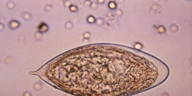 Oeuf de Schistosoma haematobium (ver responsable de la bilharziose uro-génitale). (Crédit photo : CDC)
