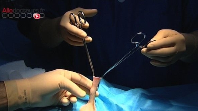 Sida : une nouvelle étude en faveur de la circoncision