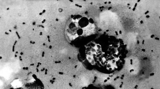 Mystérieuse recrudescence de cas de peste aux Etats-Unis