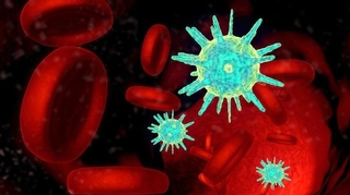 Moins de cas de sclérose en plaques chez les porteurs du VIH