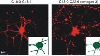 Oméga-3 et oméga-6 : leur action bénéfique sur le cerveau expliquée