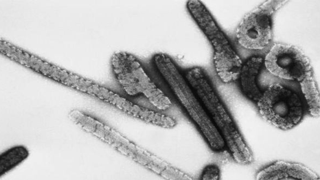 Avancée vers un traitement contre le virus de Marburg, très proche d'Ebola (Crédit photo : CDC/ Dr. Erskine Palmer, Russell Regnery, Ph.D)
