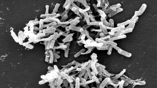 Des bactéries du genre Clostridium protègent des allergies alimentaires. Crédit: CDC/ Lois S. Wiggs (PHIL #6260), 2004
