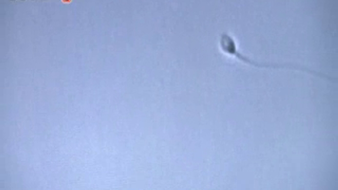 ''Fécondation in vitro : plus de réussite grâce à la 3D'', reportage diffusé le 12 novembre 2014