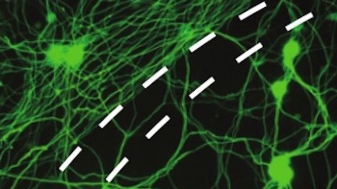 Croissance de cellules nerveuses sous l'effet de la molécule synthétisée par les chercheurs (source : Nature doi:10.1038/nature13974)
