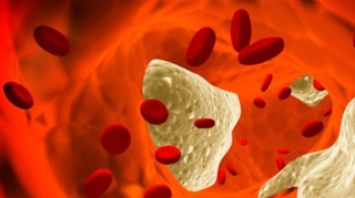 L'Europe autorise une nouvelle classe de médicaments anti-cholestérol