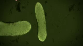 Nourrissons de Chambéry : la bactérie tueuse identifiée