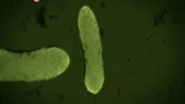 Nourrissons de Chambéry : la bactérie tueuse identifiée