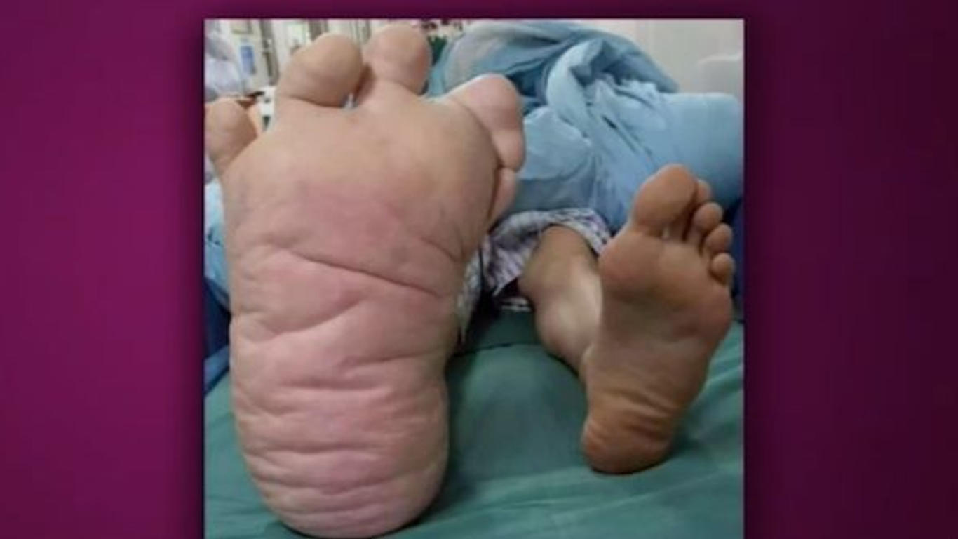 Un Chinois Au Pied Geant Opere Allodocteurs