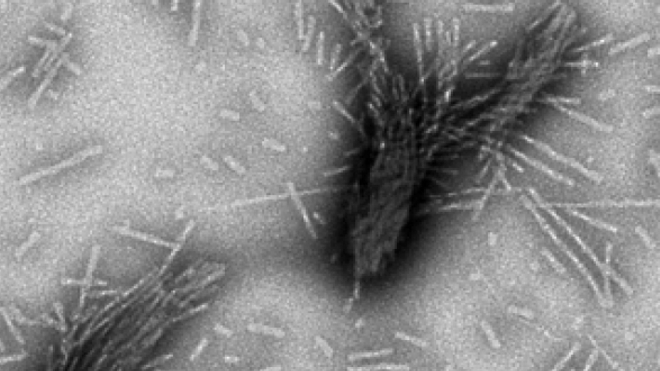 Amas d'alpha-synucléine fibrillaire comme dans les corps de Lewy, observés au microscope électronique. Les fibres ont une longueur de l'ordre des 200 nanomètres. (© Luc Bousset, CNRS)