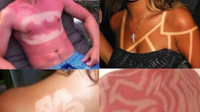 Les tatouages coups de soleils, une pratique dangeureuse. Montage twitter.