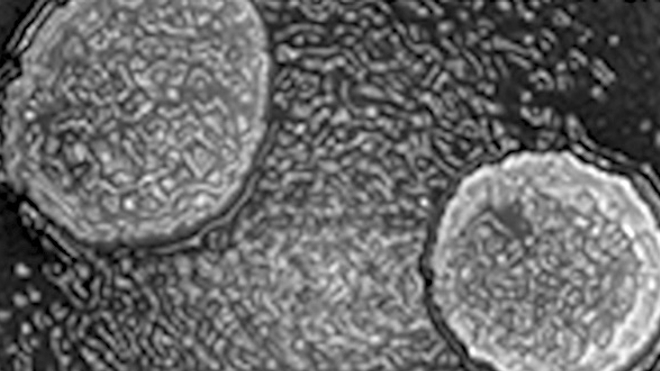 Microscopie électronique du Mollivirus (taille réelle : 0,6 micron) - © IGS CNRS/AMU
