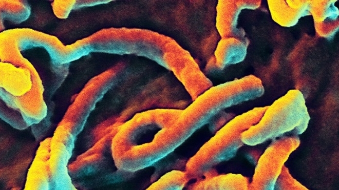 Virus Ebola : des souches mutées ne sont plus reconnues par certains traitements expérimentaux.