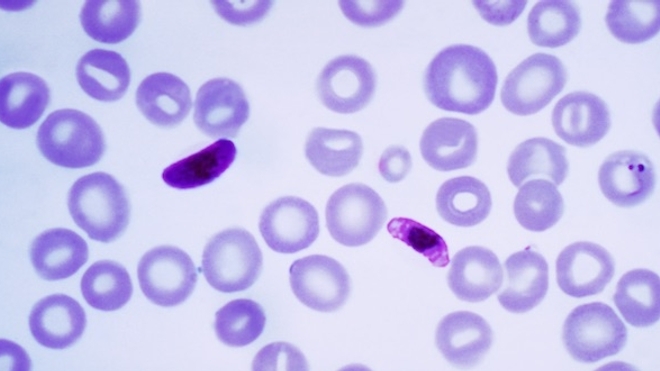 Microphotographie d'un échantillon sanguin contenant des cellules infectées par Plasmodium falciparum. (DR)
