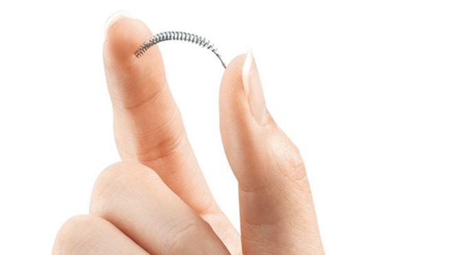 Implants contraceptifs Essure : près de 70 patientes déposent plainte au pénal