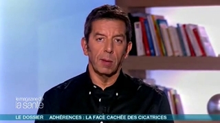 Adhérences : la face cachée des cicatrices