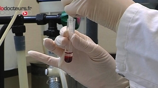 La Haute Autorité de santé confirme l'efficacité des tests sanguins de la trisomie 21