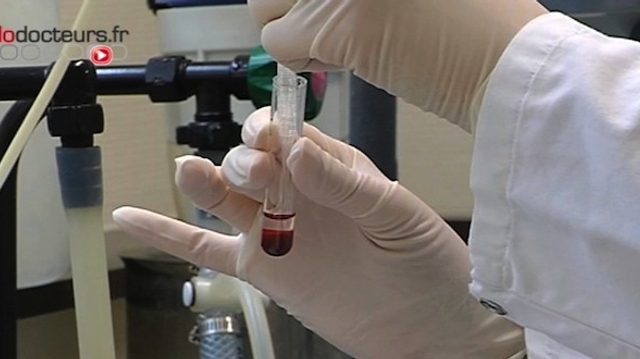 La Haute Autorité de santé confirme l'efficacité des tests sanguins de la trisomie 21