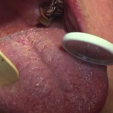 Pathologies de la bouche : quelles solutions ?