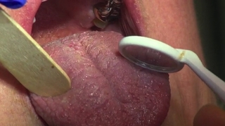 Pathologies de la bouche : quelles solutions ?