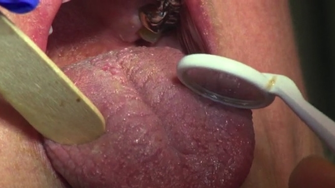 Pathologies de la bouche : quelles solutions ?