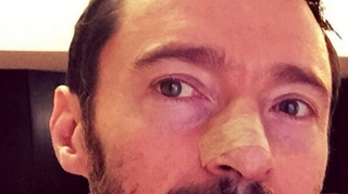 Hugh Jackman fait campagne contre le cancer de la peau