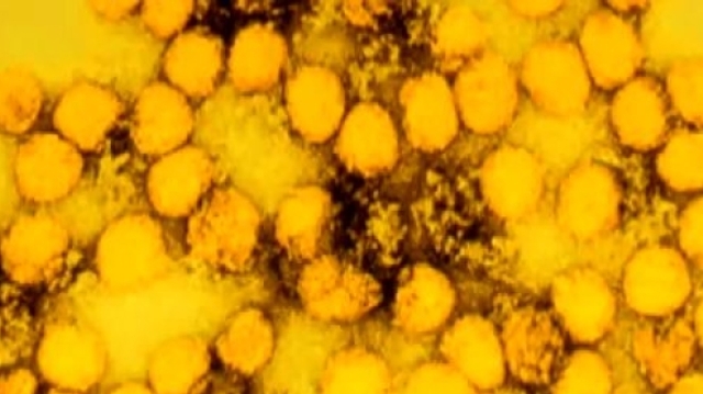 Épidémie de fièvre jaune en Angola