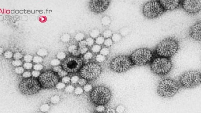 Le norovirus est le principal virus de la gastro-entérite.
