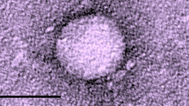 Micrographie du virus de l'hépatite C (échelle : 50 nanomètres). (DR)