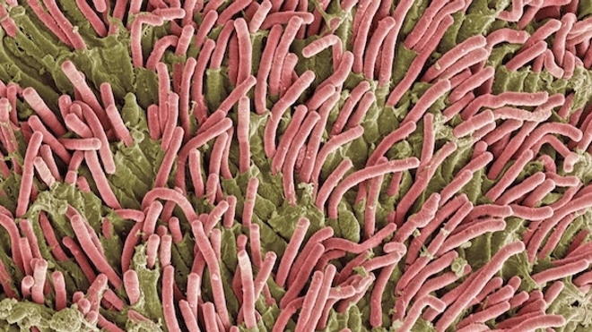 Microbiote : des spécialistes alertent sur la fiabilité des tests d'analyse